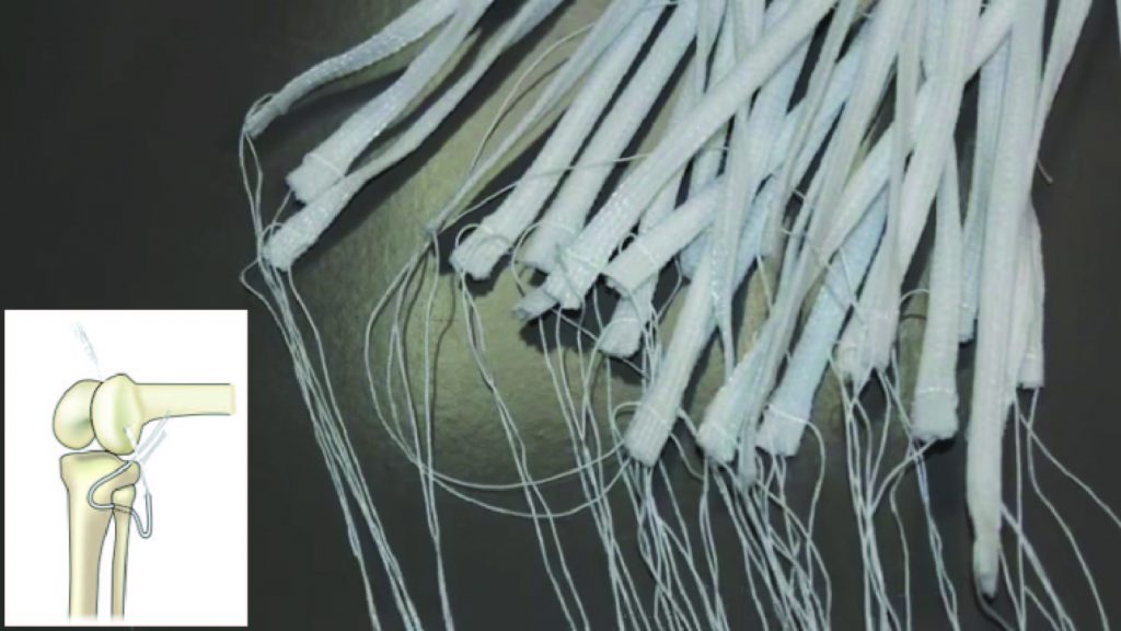 Implantable Medical Textiles Artificial Ligament Artificial Skin