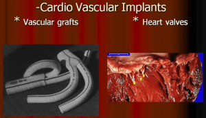 Cardio Vascular Implants 300x172