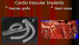 Medical Textiles | Application Field of Medical Textiles